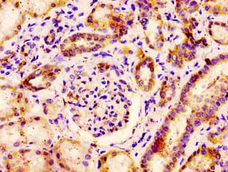Polyclonal Rabbit anti-Human PACE4 / PCSK6 Antibody (IHC)
