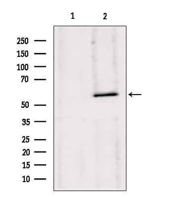 Polyclonal Rabbit anti-Human HMGCS1 / HMG-CoA Synthase 1 Antibody (IHC, IF, WB)