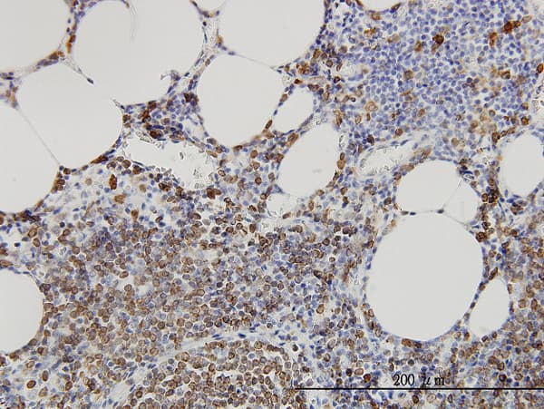 Monoclonal Mouse anti-Human SMPD2 Antibody (clone 2C9, IHC, WB)