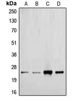 TGFB2 / TGF Beta2 Antibody (C-Terminus)