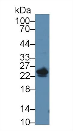 DNT / NT5C Antibody (PE)