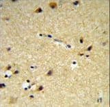 CYP26 / CYP26A1 Antibody (aa467-497)