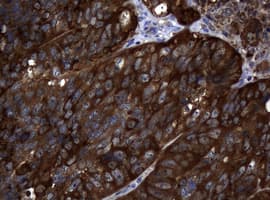 NME1 / NM23 Antibody (clone OTI24A2)