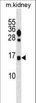 FUNDC2 Antibody (aa122-150)