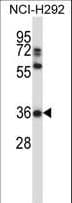 NAPSA / NAPA / Napsin A Antibody (aa368-397)