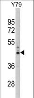 PSMD13 Antibody (aa269-298)