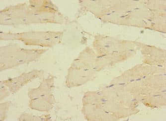 CACNA2D4 Antibody