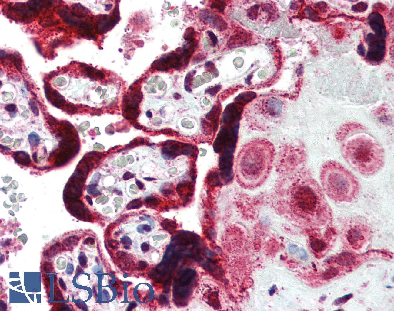 IHC-plus™ FERMT1 / Kindlin Antibody (aa643-660)
