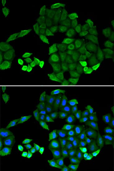 Polyclonal Rabbit anti-Human PTS Antibody (IHC, IF, WB)