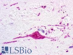 PathPlus™ P2RY1 / P2Y1 Antibody (C-Terminus)
