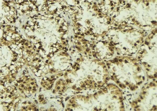 NOT1 / CNOT1 Antibody