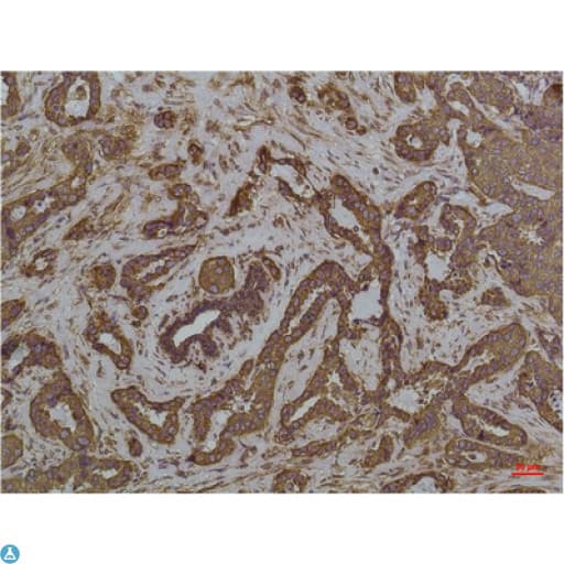 HSPA5 / GRP78 / BiP Antibody