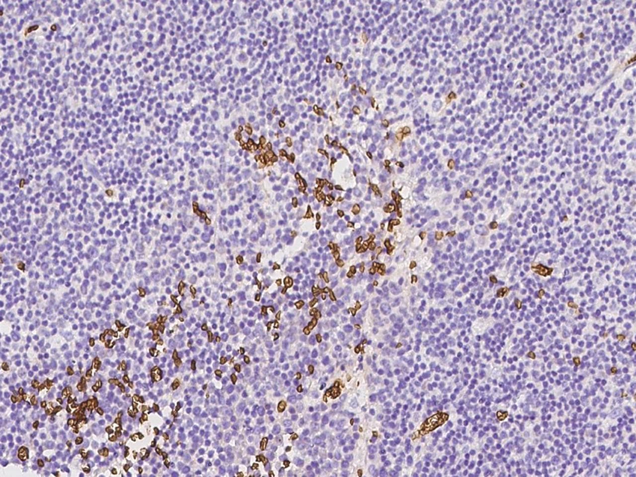 Polyclonal Rabbit anti-Human GYPC / Glycophorin C Antibody (Preservative Free, IHC, WB)
