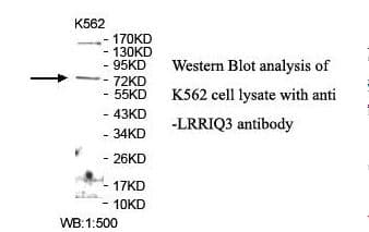 Polyclonal Rabbit anti-Human LRRIQ3 Antibody (aa29-190, IHC, WB)