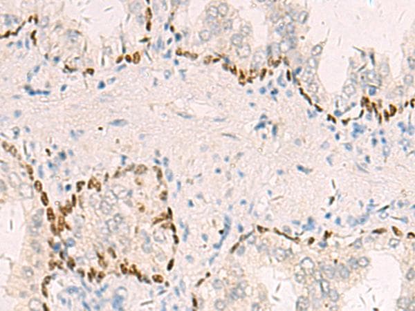 TP63 / p63 Antibody