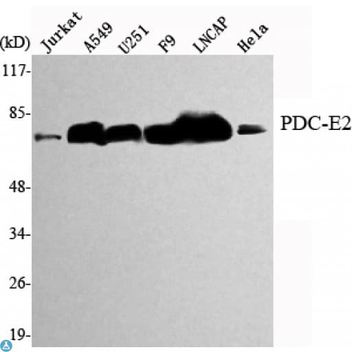 DLAT / PDC-E2 Antibody