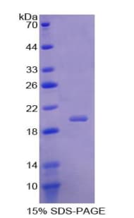 Human ACP1 / Acid Phosphatase Protein (Recombinant His)