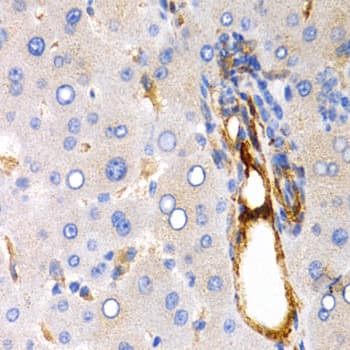 TFF1 / pS2 Antibody