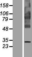 FITM1 Protein (Over-Expression Lysate Myc-DDK (Flag))