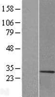 MBP / Myelin Basic Protein (Over-Expression Lysate Myc-DDK (Flag))