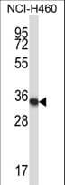 Polyclonal Rabbit anti-Mouse HOXA11 Antibody (aa141-169, WB)