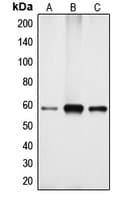 CYP4X1 Antibody (Internal)