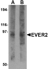 TMC8 / EVER2 Antibody