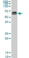 IHC-plus™ CBFA1 / RUNX2 Antibody (clone 1D8)