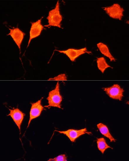 Polyclonal Rabbit anti-Human SOD3 Antibody (IF, WB)