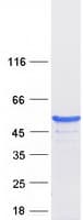 Human ASCC1 Protein (Recombinant Myc-DDK (Flag))