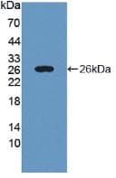 PYGL Antibody