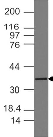 MYOD / MYOD1 Antibody