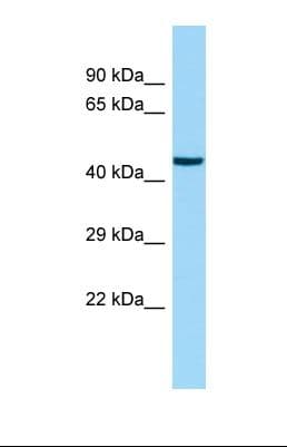 Polyclonal Rabbit anti-Human EEFSEC / EFSEC Antibody (aa387-436, WB)