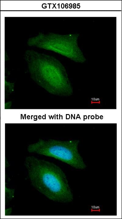 Polyclonal Rabbit anti-Human BZW2 Antibody (aa1-238, WB)