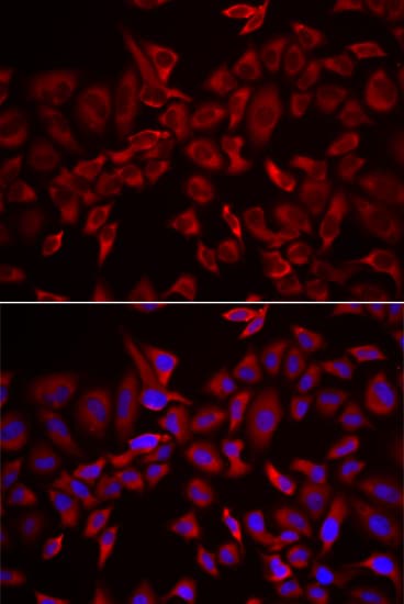 Polyclonal Rabbit anti-Human CSRP3 Antibody (IHC, IF, WB)