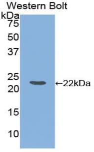FTL / Ferritin Light Chain Antibody (aa1-175, PE)