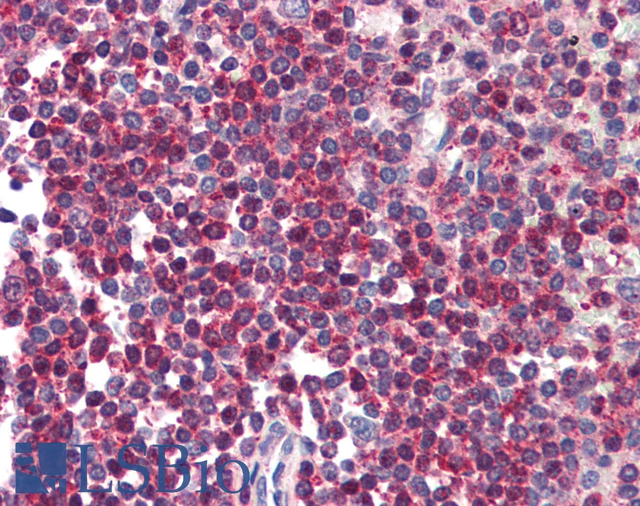 PathPlus™ HTRA2 / OMI Antibody