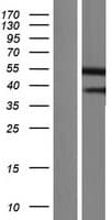 GSDMB / Gasdermin-Like Protein (Over-Expression Lysate Myc-DDK (Flag))