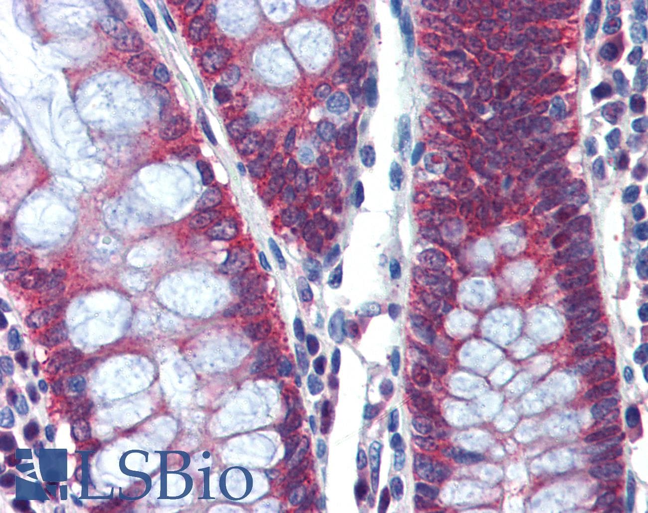 IHC-plus™ PTCH1 / Patched 1 Antibody (aa1431-1442)