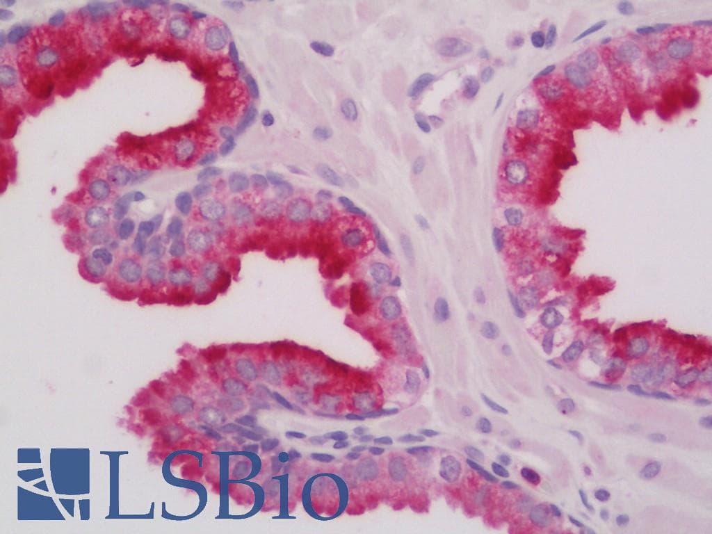IHC-plus™ Polyclonal Goat anti-Mouse RAB27A / RAB27 Antibody (C-Terminus, IHC, IF, WB)