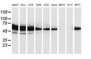 CAT / Catalase Antibody (clone OTI1B8)