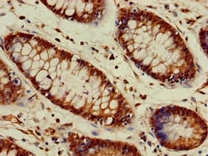 Polyclonal Rabbit anti-Human VASH2 Antibody (IHC, IF, WB)
