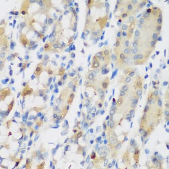 R1 / RRM1 Antibody