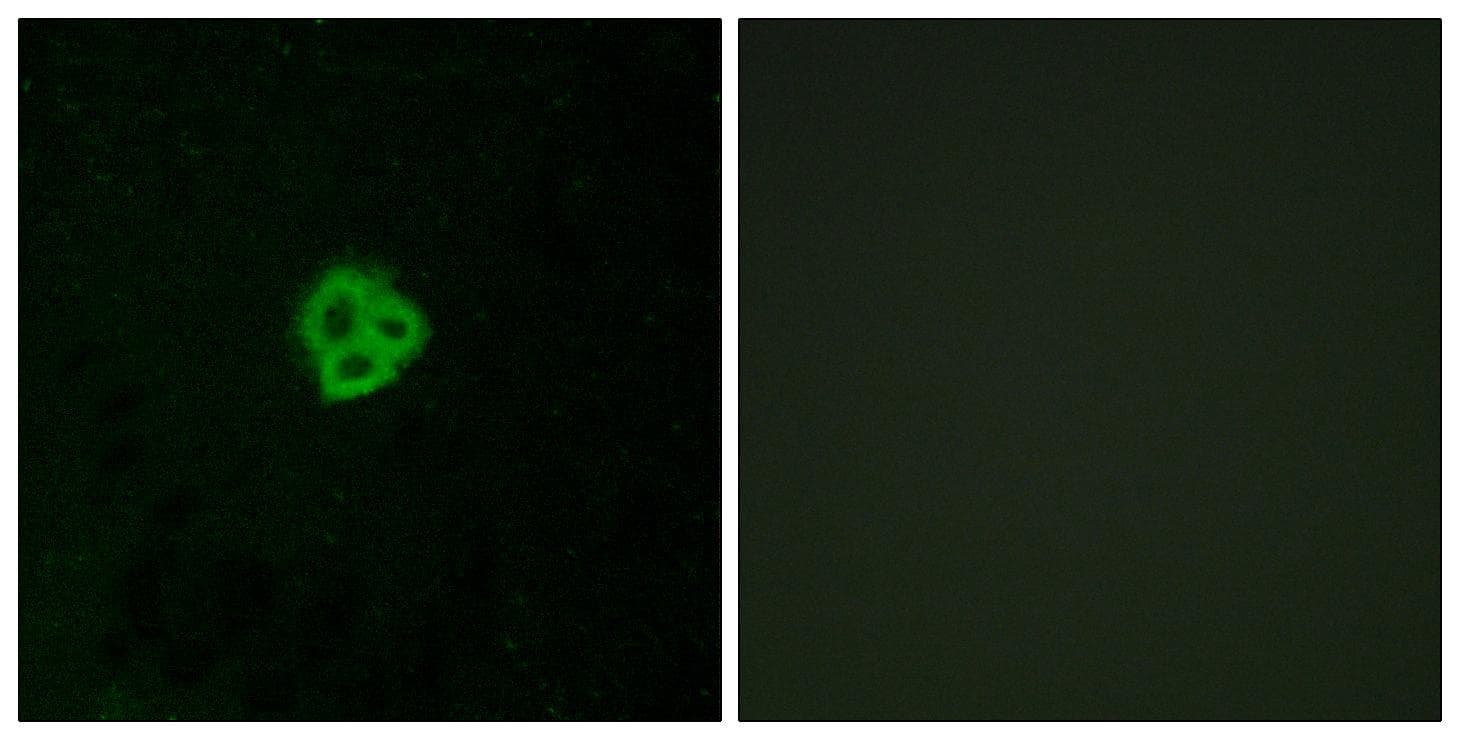AGTR1 / AT1 Receptor Antibody