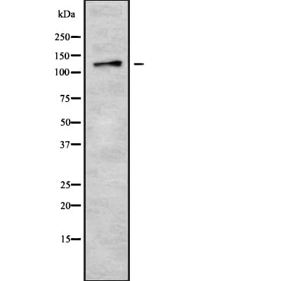 Polyclonal Rabbit anti-Human MGEA5 Antibody (IHC, WB)