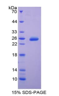 Bovine TIMP3 Protein (Recombinant His-T7)