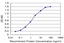 Monoclonal Mouse anti-Human PIK3C2B Antibody (clone 1H4, WB)