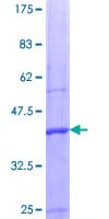Human PRMT5 Protein (Recombinant GST, N-terminus)