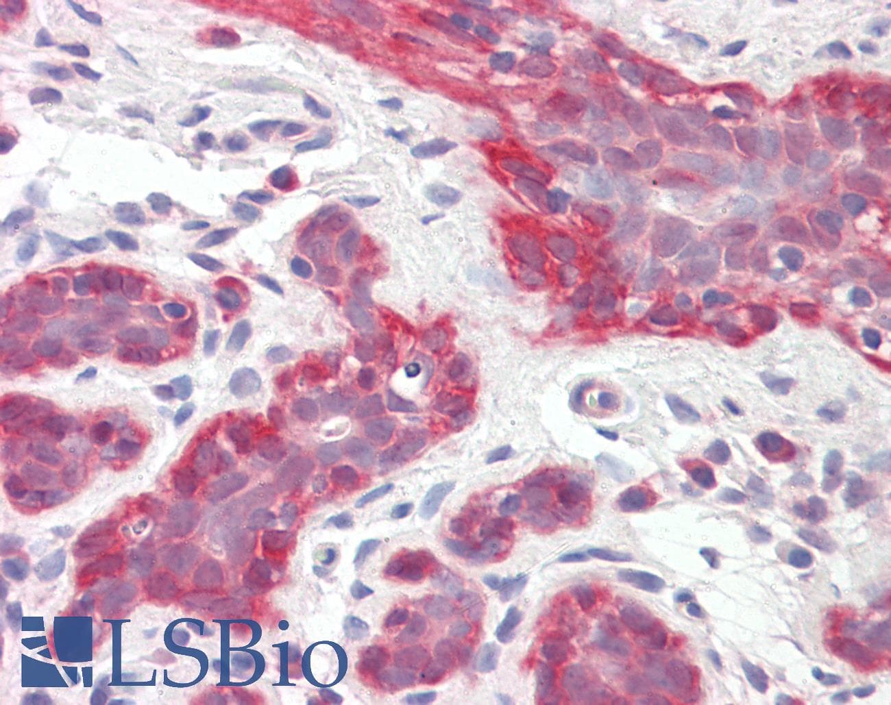 IHC-plus™ Monoclonal Mouse anti-Human AML1 / RUNX1 Antibody (clone 5A1, IHC, IF, WB)