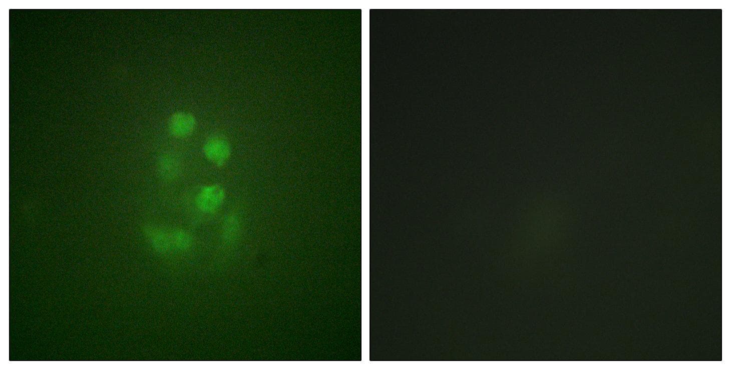 KIF2C / MCAK Antibody (phospho-Ser95)